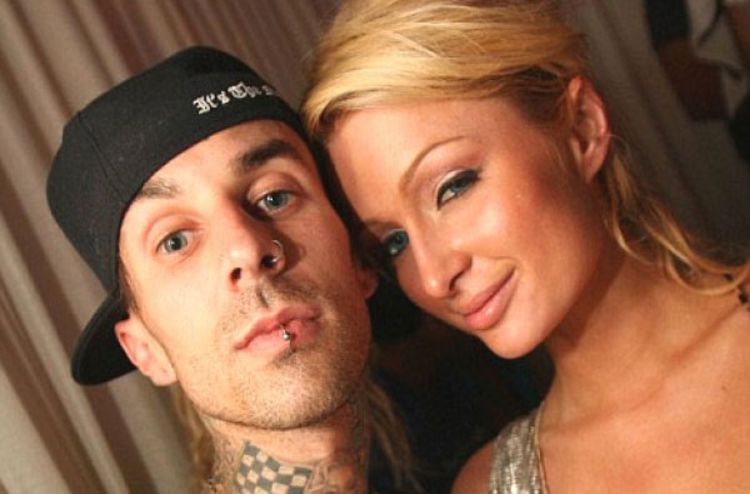 Bivši momak Paris Hilton bori se za život