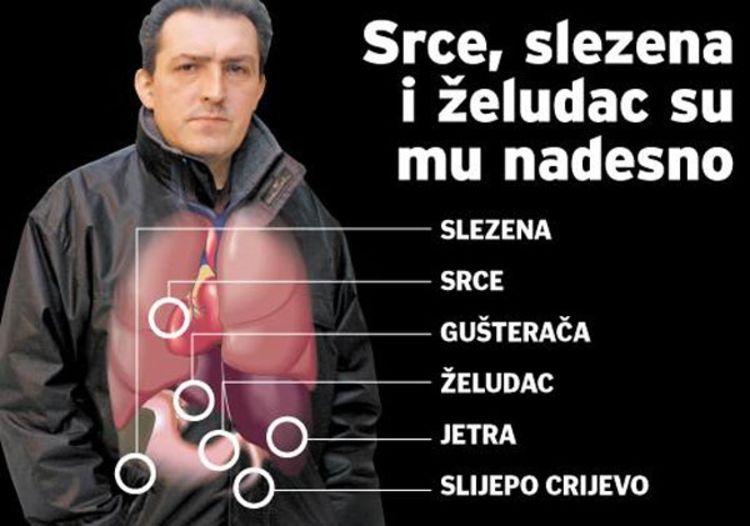 Svi mu organi na pogrešnoj strani tijela