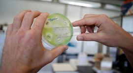 Superbakterija kod Crnogorca