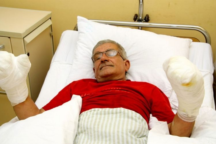  Otac i sin završili s opasnim opekotinama