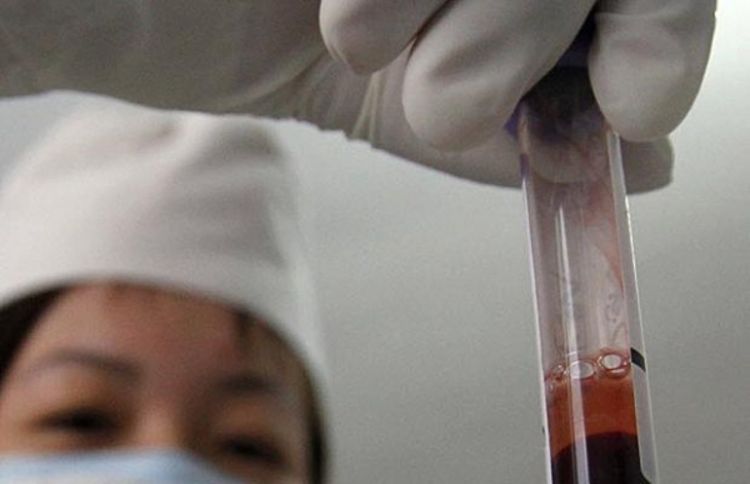 Izliječen čovjek zaražen HIV-om   