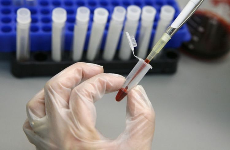 Novi lijek može da zaustavi širenje virusa HIV  