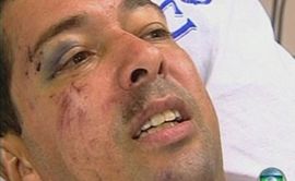 Preživio 16 sati ispod četiri metra blata