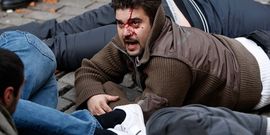Zagreb: Sukobi demonstranata i policije, ima povrijeđenih i krvavih ...