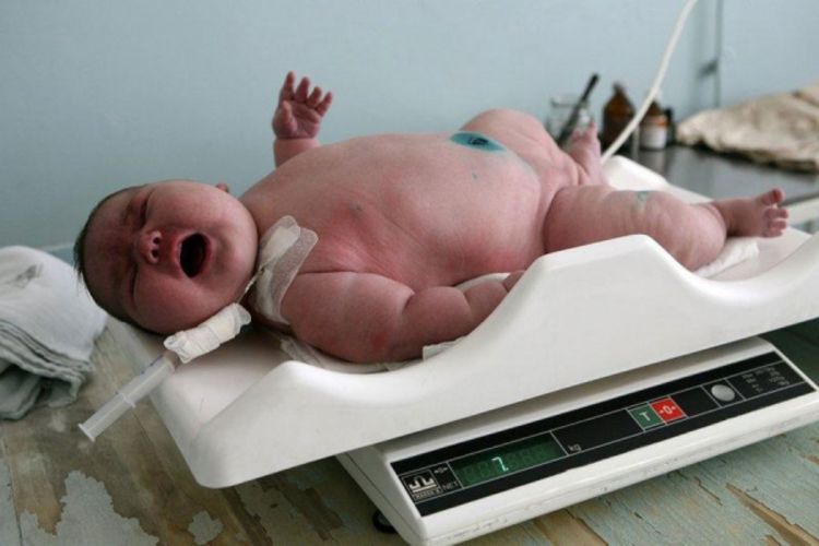 Beba teška 7,1 kilograma rođena u Bugarskoj