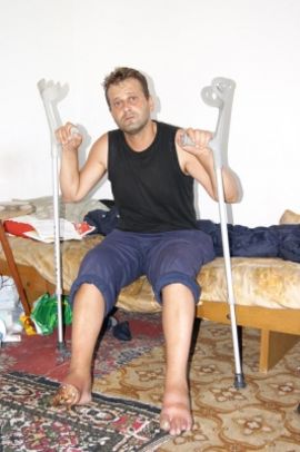 Drvosječa zbog gangrene na ivici egzistencije