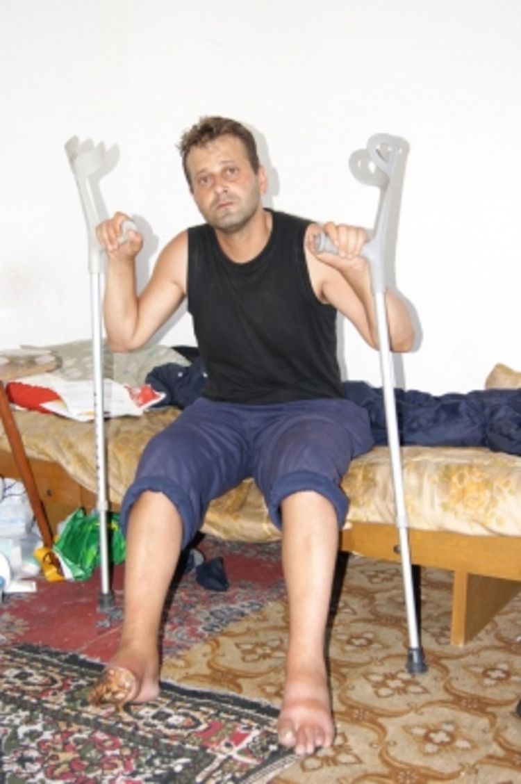 Drvosječa zbog gangrene na ivici egzistencije