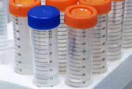 Naučnici pronašli novi antidoping test za HGH