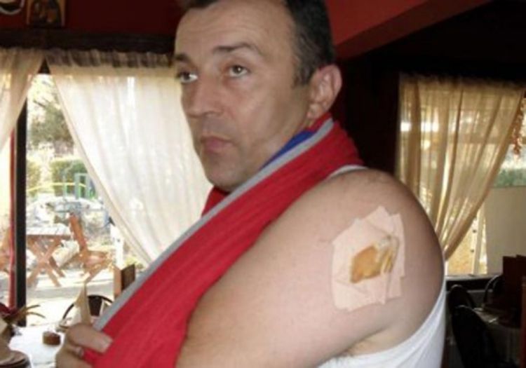 Napao mačetom četiri muškarca u sauni