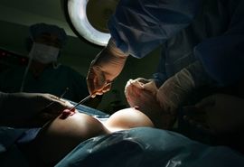 Sedam puta veća neispravnost implanata PIP