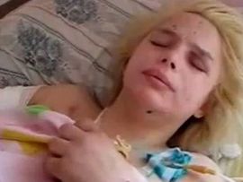 Čuveni švajcarski hirurg će liječiti silovanu i spaljenu Ukrajinku ...