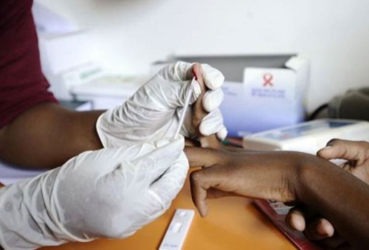 Kinezi razvijaju gel za zaustavljanje širenja AIDS-a