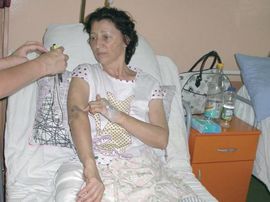 Zbog keca polomio kuk profesorki