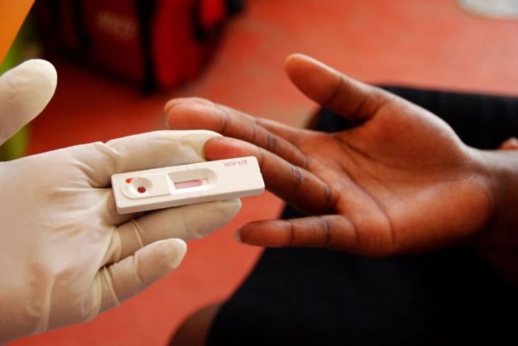 Svaka druga HIV pozitivna osoba u Srbiji to ne zna