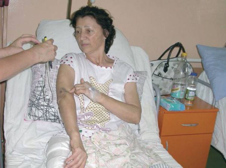 Zbog keca polomio kuk profesorki