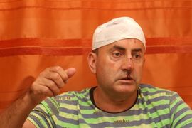 Ispovijest brutalno pretučenog Banjalučanina: Znam ko je naručio ...