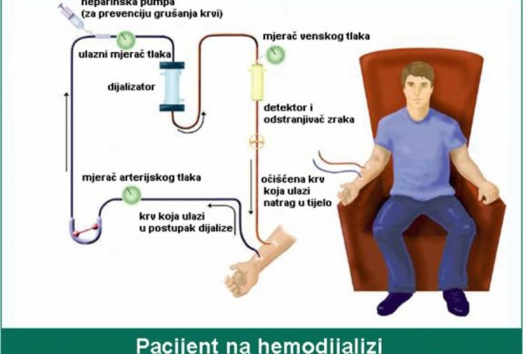 U Prijedoru hemodijaliza za pacijente iz Sanskog Mosta