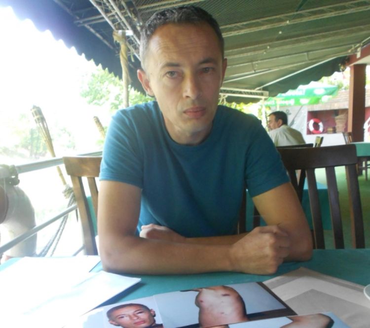 "Inspektor me tukao i častio goste lokala"