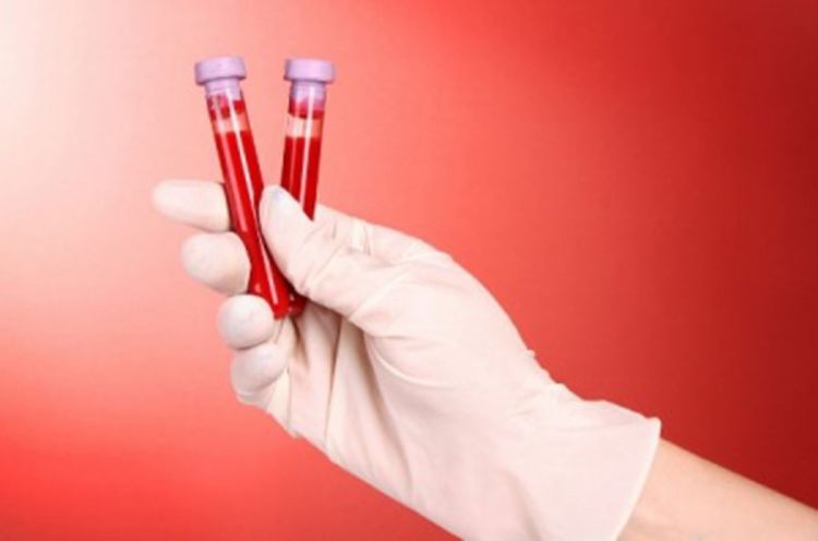 U ambulanti u Verićima laboratorija za analizu krvi