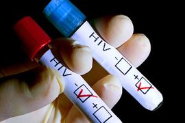 Pred sudom jer je HIV-om namjerno zarazio Srbina