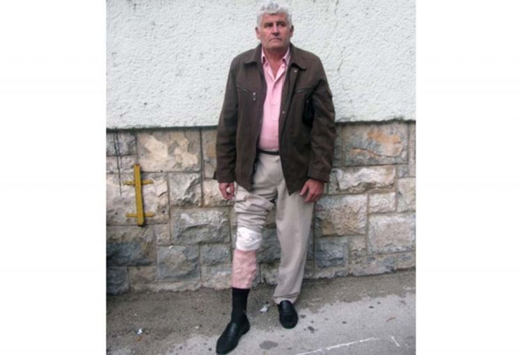 Prijavio da ga je ujeo pas