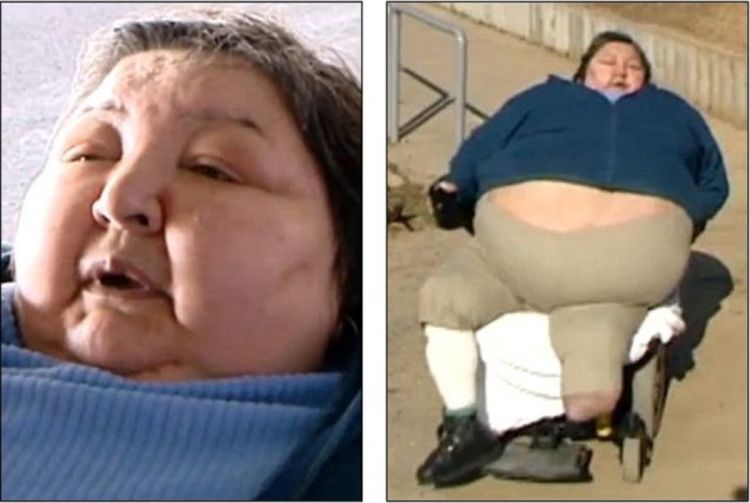 Tužba protiv aviokompanija zbog smrti putnice "predebele za let"