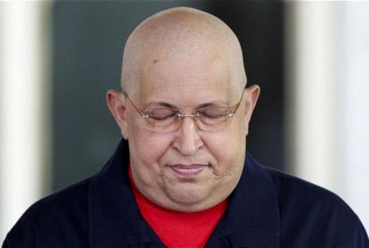 Hugo Čavez se bori za život