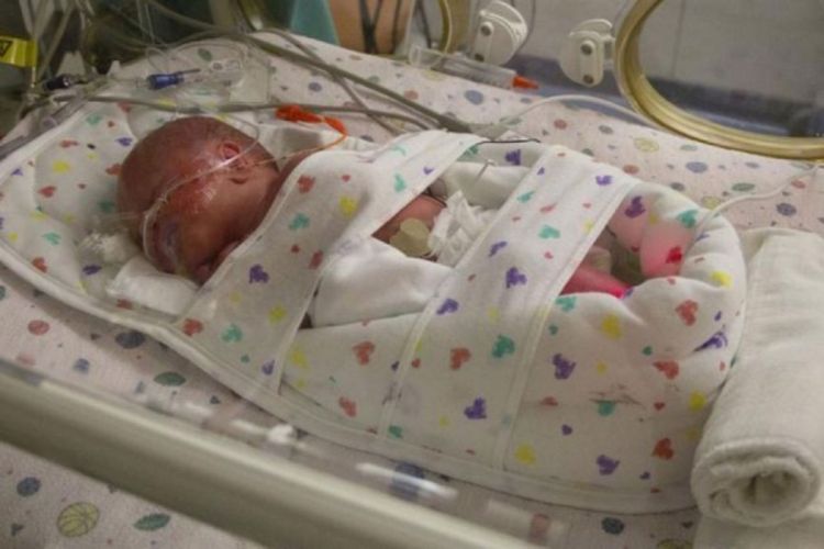 SUPERMAMA: Rodila blizance nasred auto-puta, sama probušila vodenjak