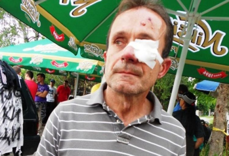 Vulić: Dok su me vezali policajac mi je gurnuo prst u oko, a požar su mi namjestili