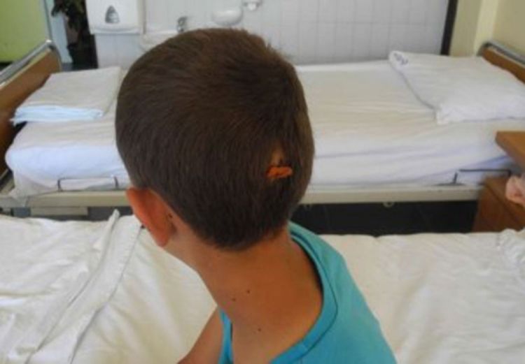Dječak koji je za dlaku izbjegao smrt: Čuo sam krike putnika dok je autobus padao u provaliju