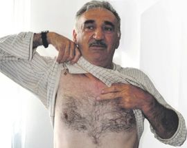 Medicinski fenomen iz Prijedora: Srce mu sedam sati bilo u frižideru