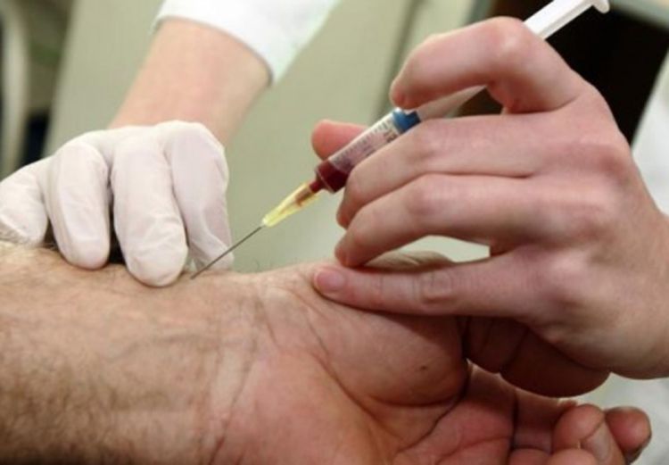 Besplatno testiranje na hepatitis