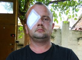  Moler greškom uhapšen kao ubica: Dobio batine i dva dana zatvora