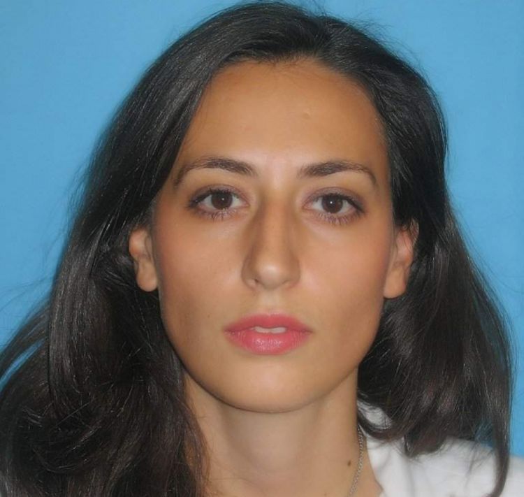 Lejla Ibričević-Balić, hematolog: Anemija se liječi ovisno o uzroku