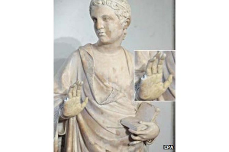 Hirurg polomio prst muzejskoj statui