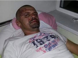 Hajdarević teško pretučen u svom kafiću: Prvi me udario ministar ...