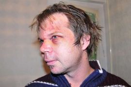 Ovo je lice Srbije: Nastavnik koga su osnovci mučki tukli dok nije ...