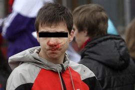 Nasilje među osnovcima: Lome kičme, mažu se fekalijama, tuku ...