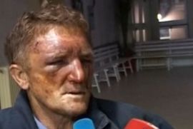 MUP: Tri uhapšena lica ne mogu se dovesti u vezu s napadom na Đurića