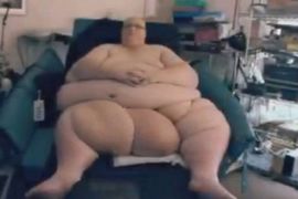 Najdeblji čovjek smršao 305 kilograma i odmah našao djevojku