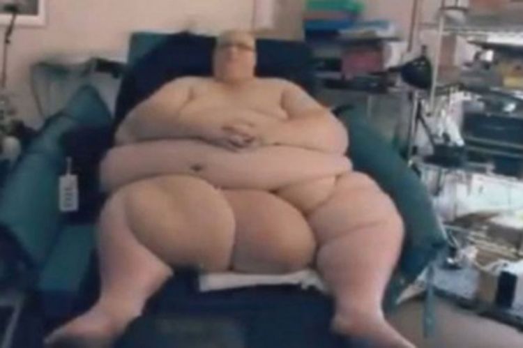 Najdeblji čovjek smršao 305 kilograma i odmah našao djevojku