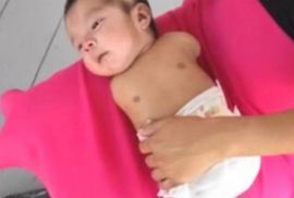 Uznemirujući sadržaj: Šokantan snimak uticaja pesticida na razvoj ...