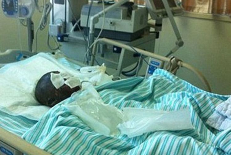 Natjerala sina (4) da pije benzin, pa zapalila sebe, njega i muža