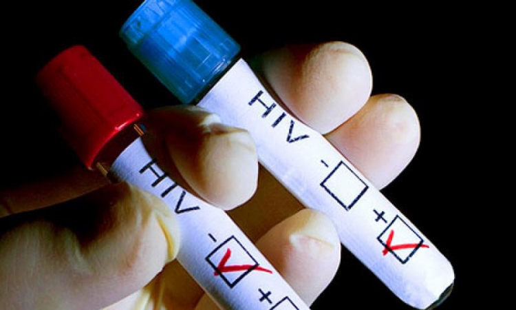 U BiH 245 osoba zaraženo HIV-om