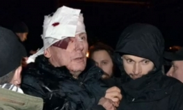 Pretučen lider opozicije