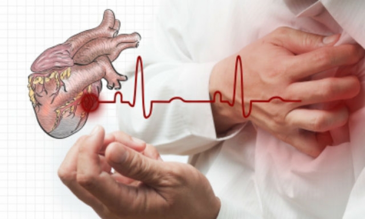 Novi test predviđa rizik za infarkt