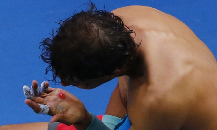 Nadal uz krvavu šaku preokretao rezultat protiv Nišikorija