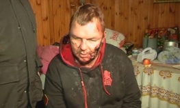 Pretučeni opozicionar Bulatov obećava nastavak borbe