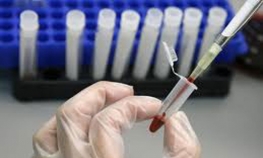 Banjaluka: U petak besplatno testiranje na HIV i hepatitise