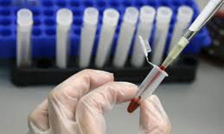 Banjaluka: U petak besplatno testiranje na HIV i hepatitise